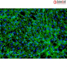 Human Dermal Fibroblasts-neonatal