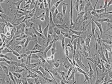 HLA-A*01 Positive Human Skin Primary Dermal Fibroblasts-adult, Passage 1