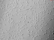 HLA-A*01 Positive Human Skin Primary Dermal Fibroblasts-adult, Passage 1