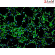 HLA-A*01 Positive Human Skin Primary Dermal Fibroblasts-adult, Passage 1