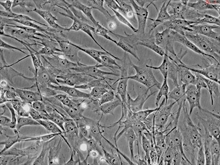 Human Dermal Fibroblasts-Fetal-Mitomycin C treated