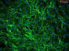 Human Dermal Fibroblasts-Fetal-Mitomycin C treated