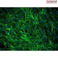 Human Dermal Fibroblasts-Fetal-Mitomycin C treated