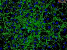 Human Hair Germinal Matrix Cells, Passage 1