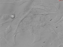 Human Hair Outer Root Sheath Cells, Passage 1