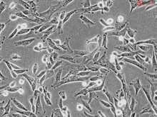 Human Hair Inner Root Sheath Cells, Passage 1