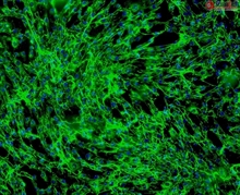 Human Hair Inner Root Sheath Cells, Passage 1