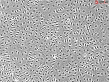 Human Primary Lymphatic Endothelial Cells, Passage 1, CD31+