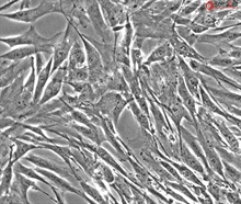 Cryopreserved Human Lymphatic Fibroblasts