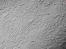 Cryopreserved Human Lymphatic Fibroblasts