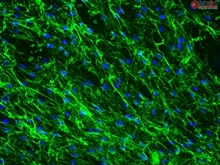 Cryopreserved Human Lymphatic Fibroblasts