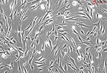 Cryopreserved Human Periodontal Ligament Fibroblasts, HPLF