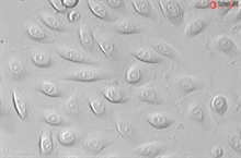 Human Primary Esophageal Microvascular Endothelial Cells, Passage 1