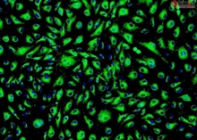 Human Primary Esophageal Microvascular Endothelial Cells, Passage 1