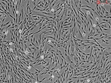 Human Intestinal Fibroblasts