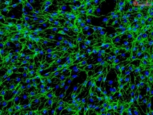 Human Intestinal Fibroblasts