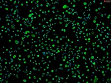 Human Primary Colonic Epithelial Cells (HCoEpiC), Passage 1