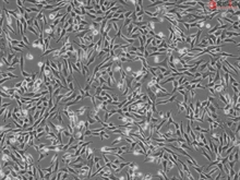 Human Rectal Smooth Muscle Cells, Passage 1