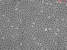 Human Pulmonary Microvascular Endothelial Cells HPMEC, Passage 1