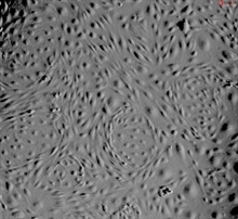 Human Pulmonary Microvascular Endothelial Cells HPMEC, Passage 1