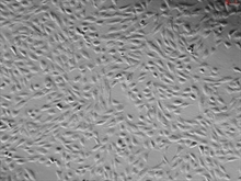 Human Pulmonary Artery Endothelial Cells, Passage 1