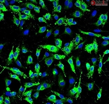 Human Pulmonary Artery Endothelial Cells, Passage 1