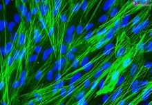 Human Pulmonary Artery Smooth Muscle Cells, Passage 1