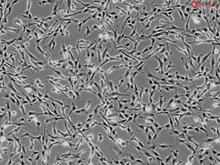 Human Pulmonary Artery Adventitial Fibroblasts