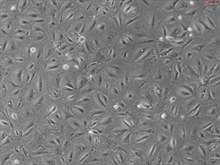 Human Pulmonary Alveolar Epithelial Cells, HPAEpiC, Passage 1