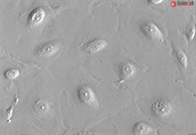 Human Pulmonary Alveolar Epithelial Cells, HPAEpiC, Passage 1