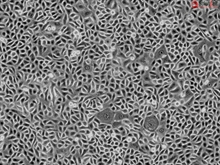 Human Bronchial Epithelial Cells, Passage 1