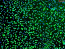 Human Bronchial Epithelial Cells, Passage 1