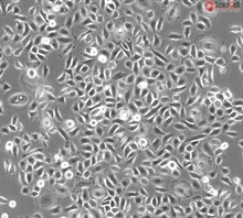 Human Small Airway Epithelial Cells, Passage 1