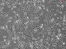 Human Pulmonary Fibroblasts