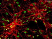 Human Pulmonary Fibroblasts