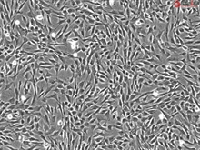 Human Bronchial Smooth Muscle Cells, Passage 1