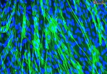 Human Tracheal Smooth Muscle Cells, Passage 1