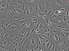 Human Adrenal Microvascular Endothelial Cells, Passage 1