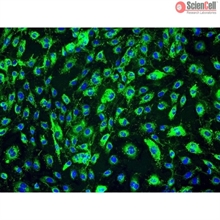 Human Adrenal Microvascular Endothelial Cells, Passage 1