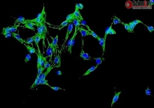 Human Adrenal Fibroblasts