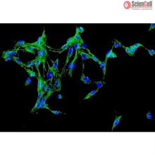 Human Adrenal Fibroblasts