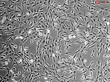 Human Thyroid Fibroblasts