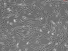 Human Pancreatic Stellate Cells, Passage 1