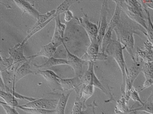 Human Pancreatic Stellate Cells, Passage 1