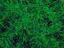 Human Pancreatic Stellate Cells, Passage 1