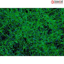 Human Pancreatic Stellate Cells, Passage 1