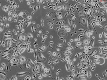 Human Thymic Epithelial Cells, Passage 1