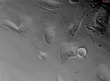 Human Thymic Epithelial Cells, Passage 1