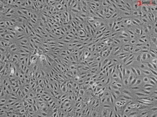 Human Primary Renal Glomerular Endothelial Cells, Passage 1, CD31+, vWF/Factor VIII+