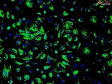 Human Primary Renal Glomerular Endothelial Cells, Passage 1, CD31+, vWF/Factor VIII+